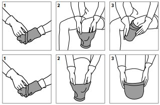 Stumpkompressionsstrømpe - påtagning - Sahva