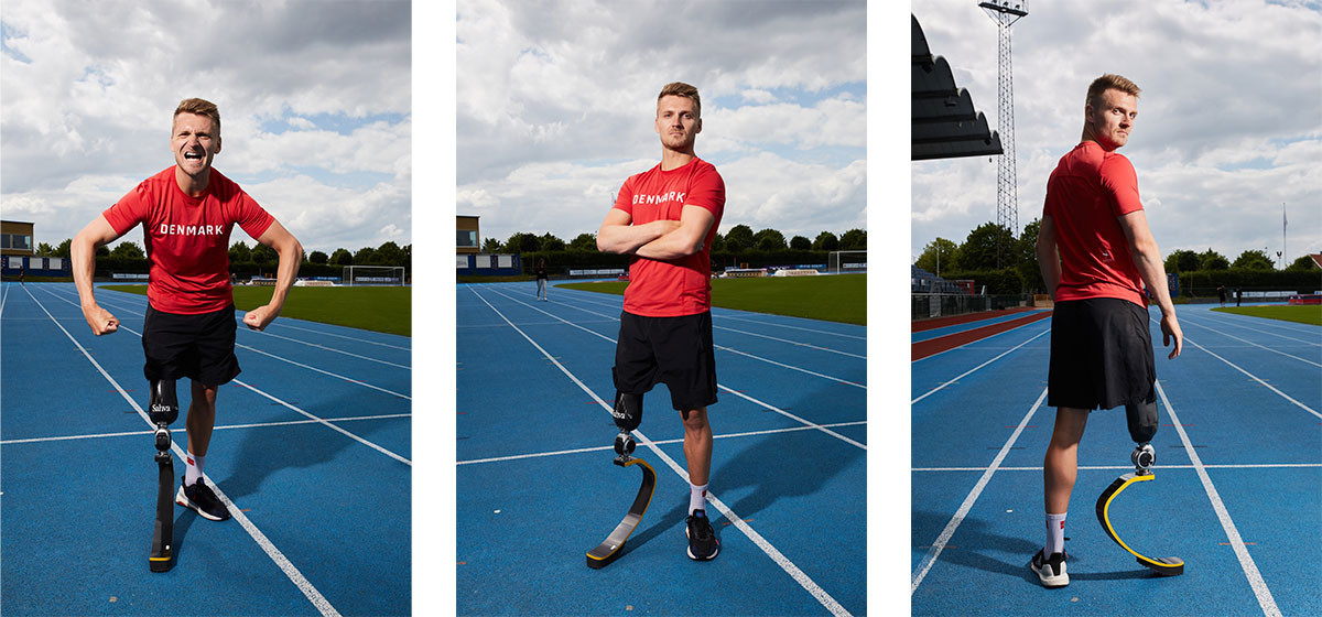 Daniel Wagner med sin løbeprotese