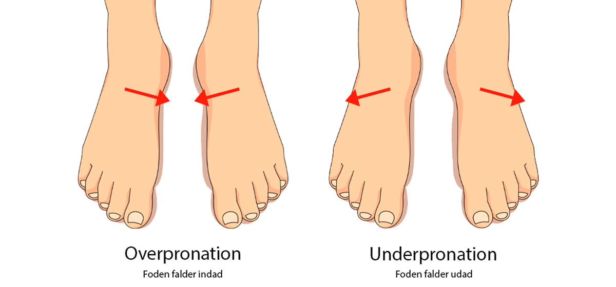 Hvad er forskellen på under- eller overpronation? - Sahva