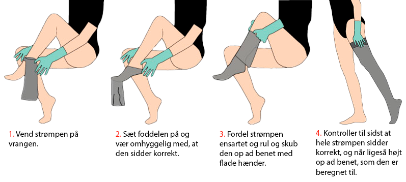 Sådan tager du kompressionsstrømper korrekt på - Sahva