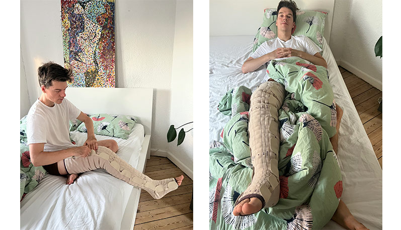 Sebastian sover med Mobiderm natbandager - Sahva