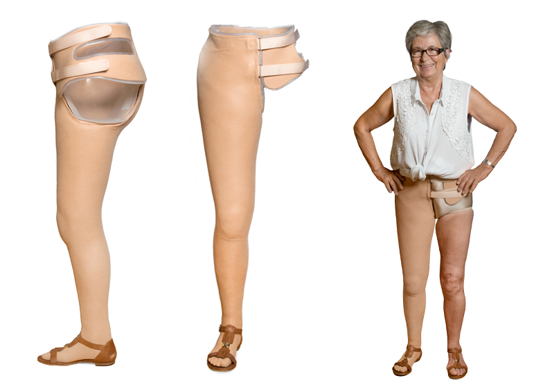 Kvinde med hofteledsprotese - Sahva