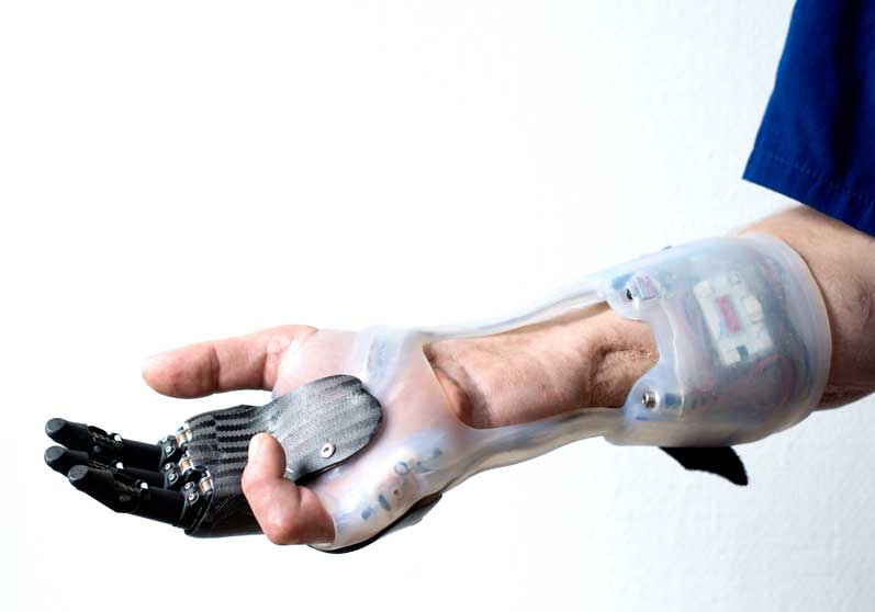 Billede af delhånd - Sahva