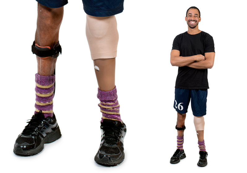 Mand med underbensprotese - Sahva