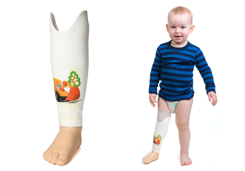 Dreng med underbensprotese - Sahva