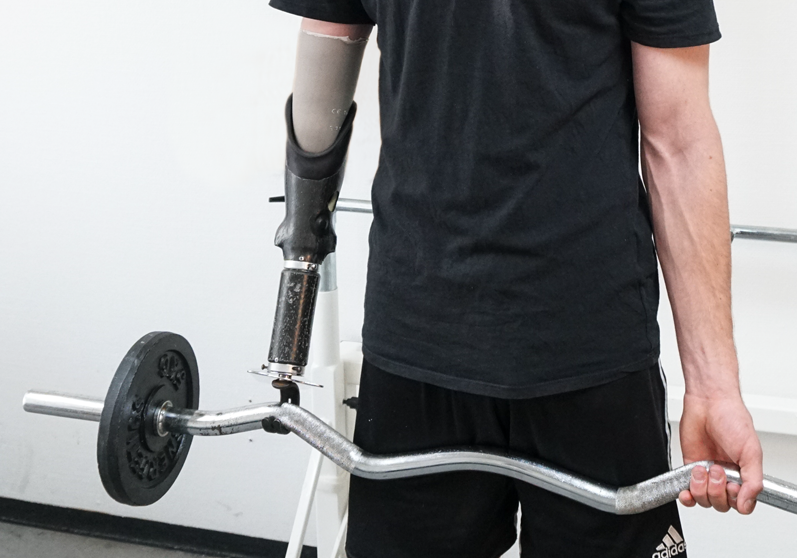 Mand med armprotese løfter håndvægte - Sahva