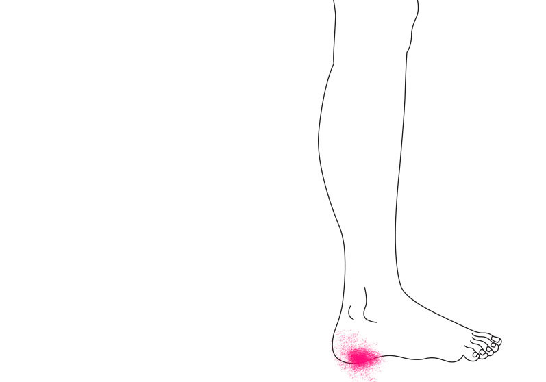 Illustration af hælpuden - Sahva