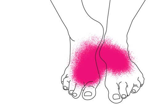 Gigt i fødderne forklaring - Sahva