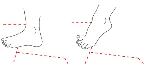 Øvelse for achillesscene