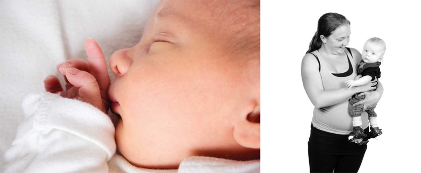 Baby der sover og mor der holder sin baby med klumfod