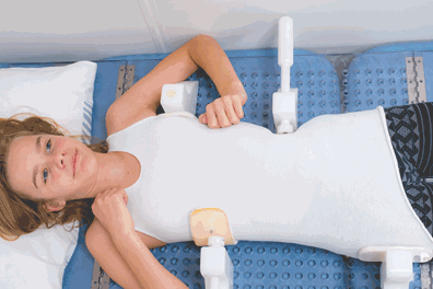 Pige får opmålt sit providence nightbrace korset