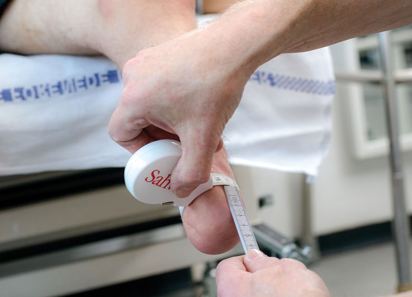 Måltagning af benstump