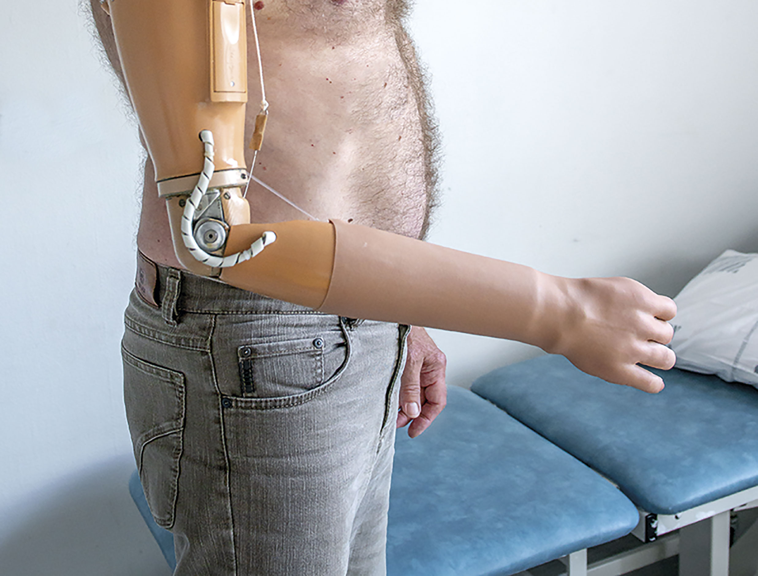 Aktivt mekanisk albueled - Sahva