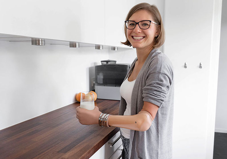 Kvinde med bionisk hånd - Sahva