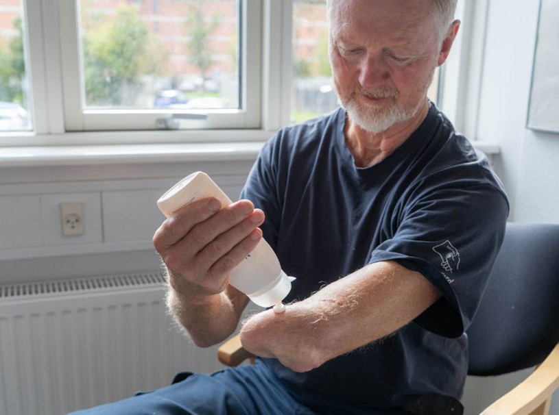 Mand smører mild hudcreme uden parfume på sin armstump