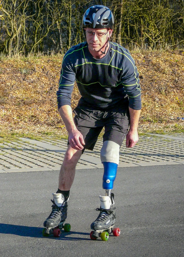 Sune kører på rulleskøjter med 3D printet hylster til sin protese
