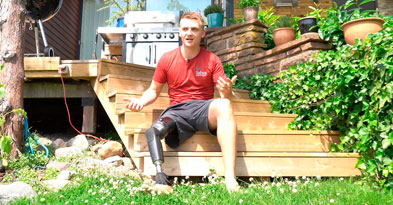 Tips til flyrejsen med benprotese - Sahva