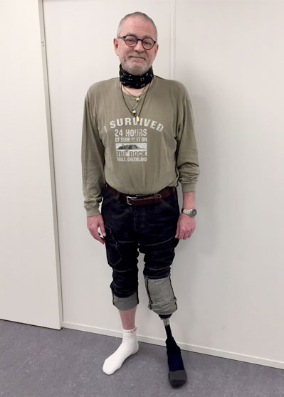 Benprotese - diabetes