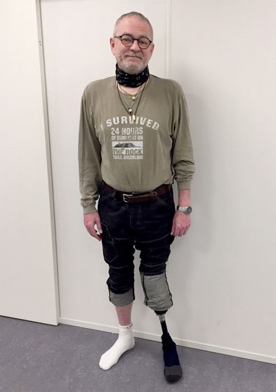 Benprotese - diabetes Benprotese - diabetes