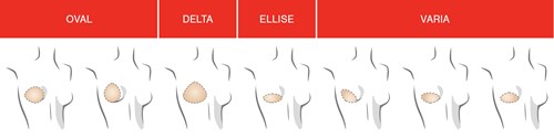 4 faconer af breast shapers fra Amoena