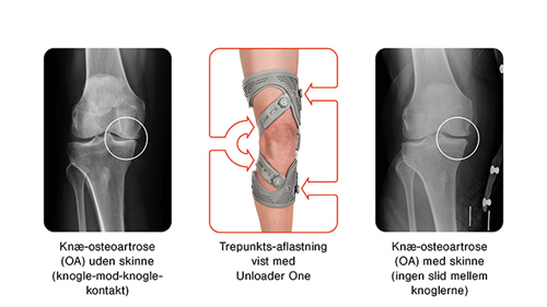 Unloader - før og efter - Sahva