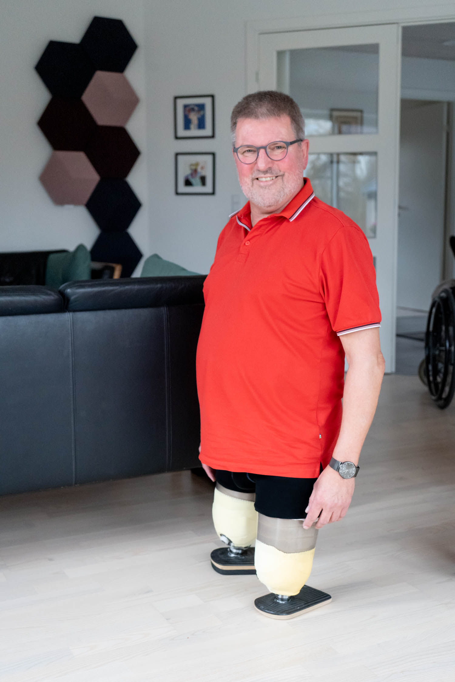 Dobbelt lårbensamputeret og på stubbies