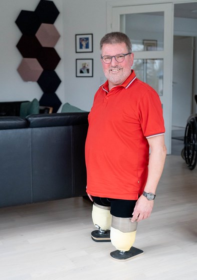 Dobbelt lårbensamputeret og på stubbies Dobbelt lårbensamputeret og på stubbies