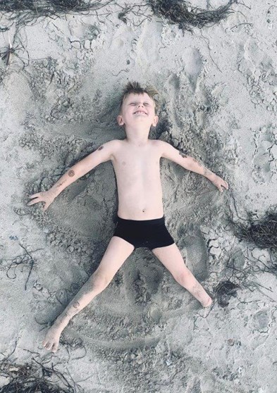 Forældrene valgte amputation Forældrene valgte amputation