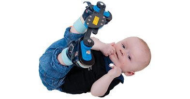 Klumpfodsbehandling til børn - Sahva