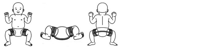 D B Skinne til hoftedysplasi - børn - Sahva