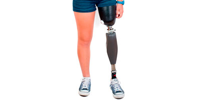 Lårbensprotese - Sahva