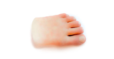 Delfodsproteser - Sahva