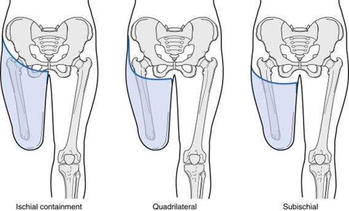 Hylstertyper TF Sahva